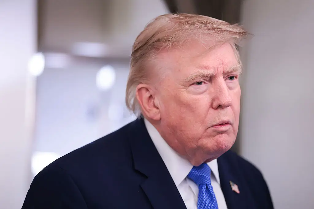 Footage from August 2, though (just a few days before the speech), showed more of Trump’s scalp than usual (Anna Moneymaker/Staff/Getty Images)