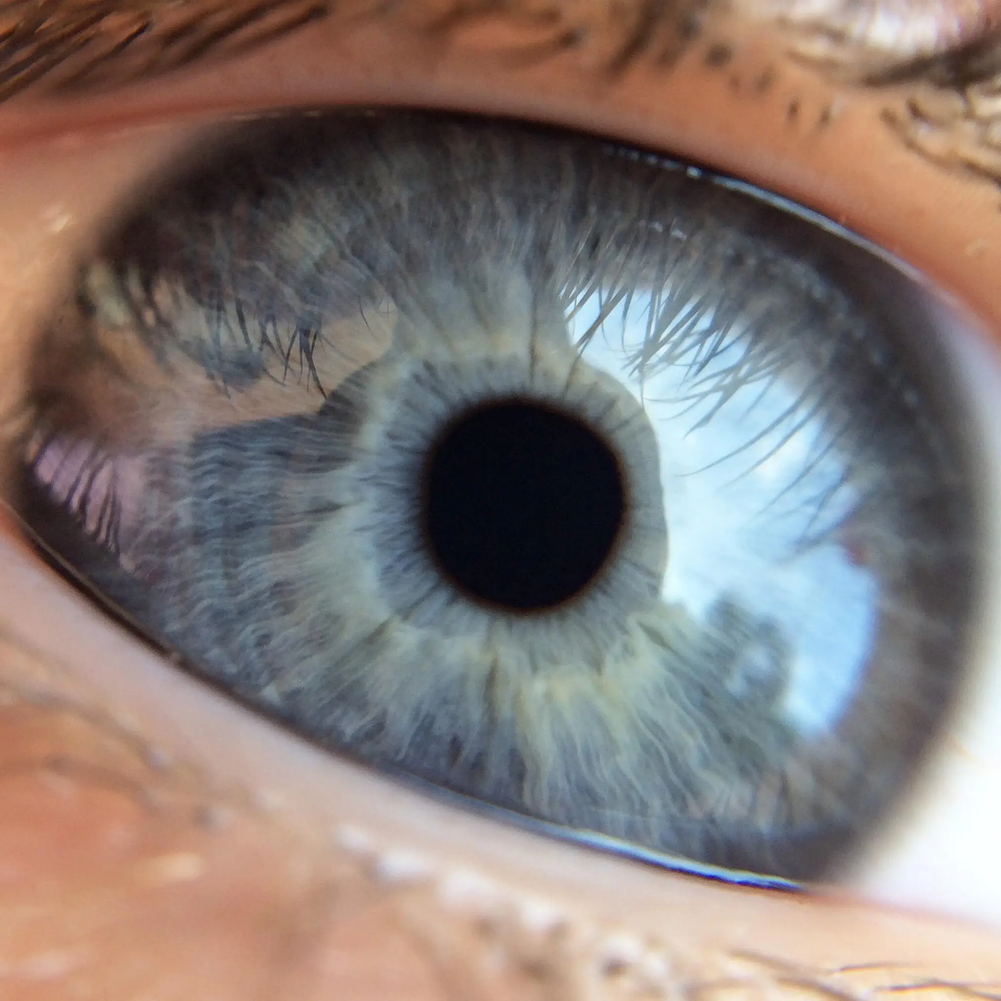 You may already have the parasite.