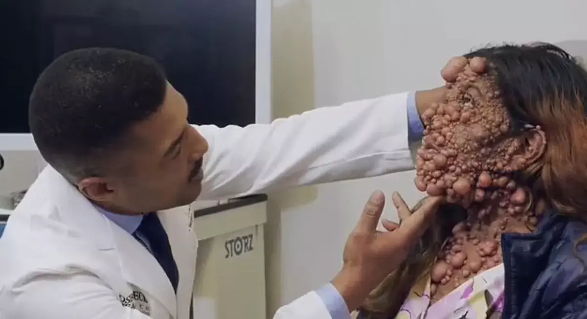 Charmaine Sahadeo was struggling to breathe, eat, talk and walk due to her condition.