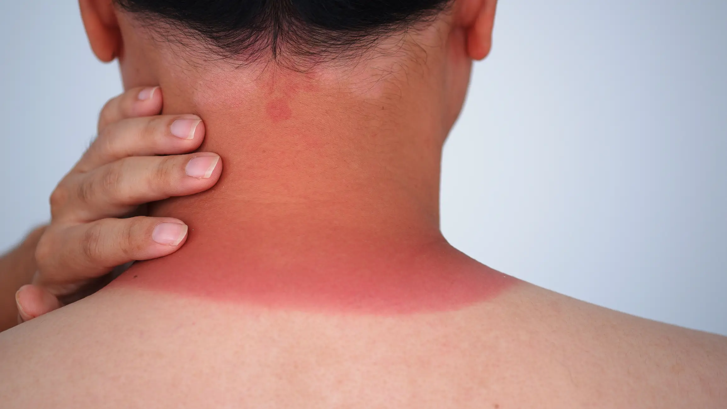 The jab could make users prone to skin sensitivity and sunburn (Getty Stock Image)