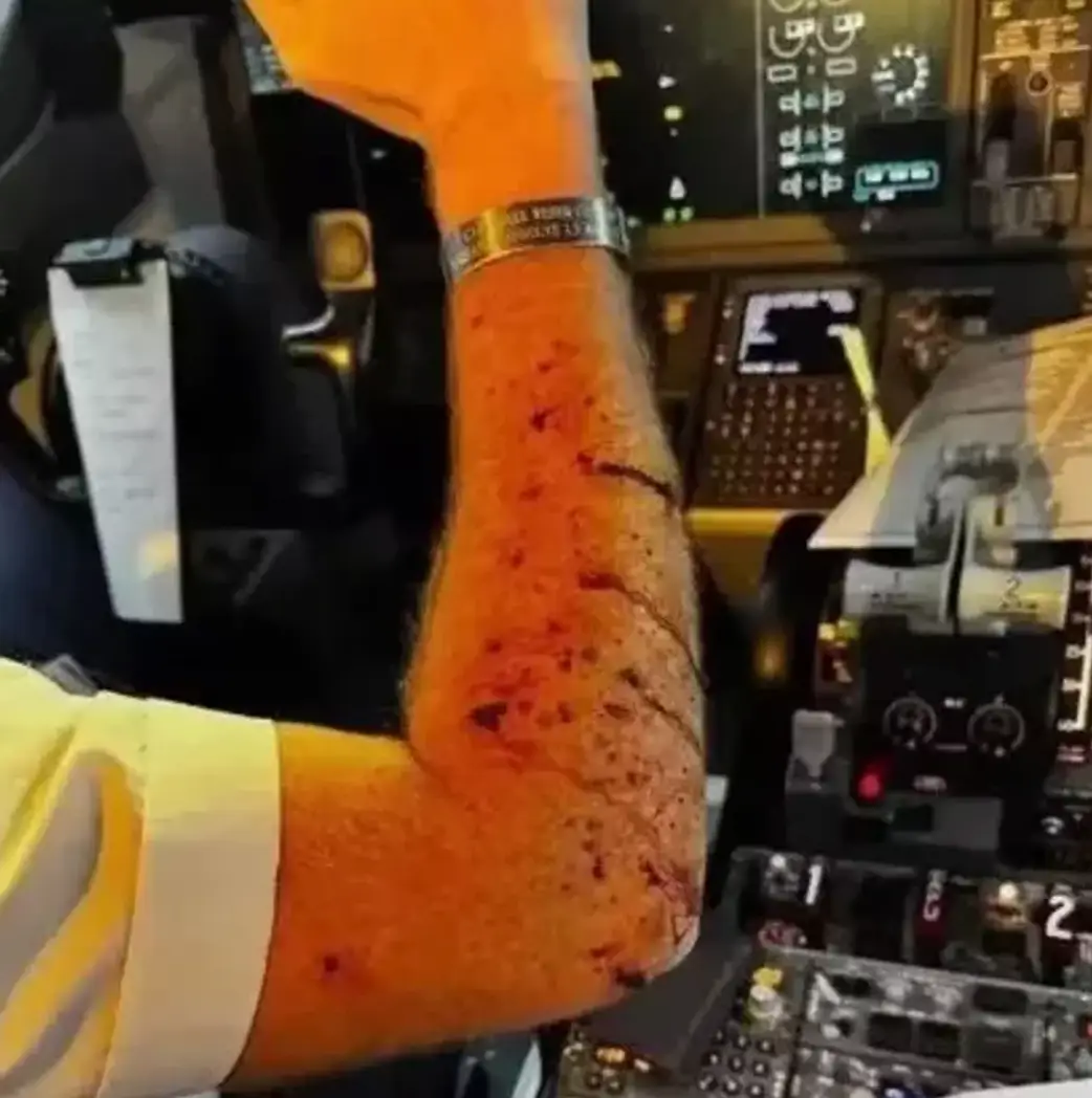 The pilot was left injured (X)