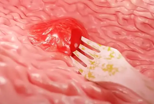 The fork had become lodged in Gardner's stomach (YouTube/Zack D. Films)