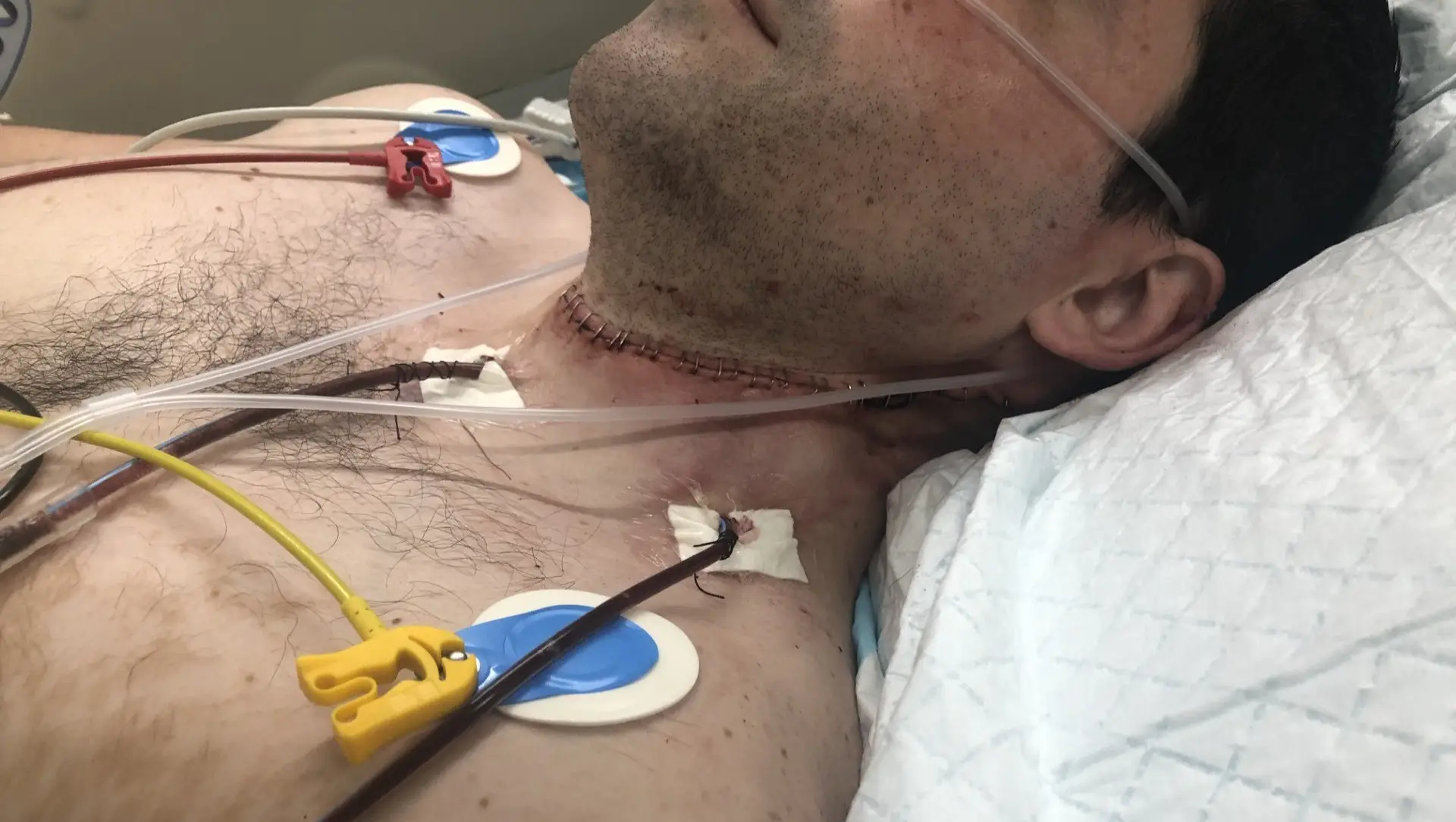 He's had countless invasive surgeries and treatments (Cover Images)