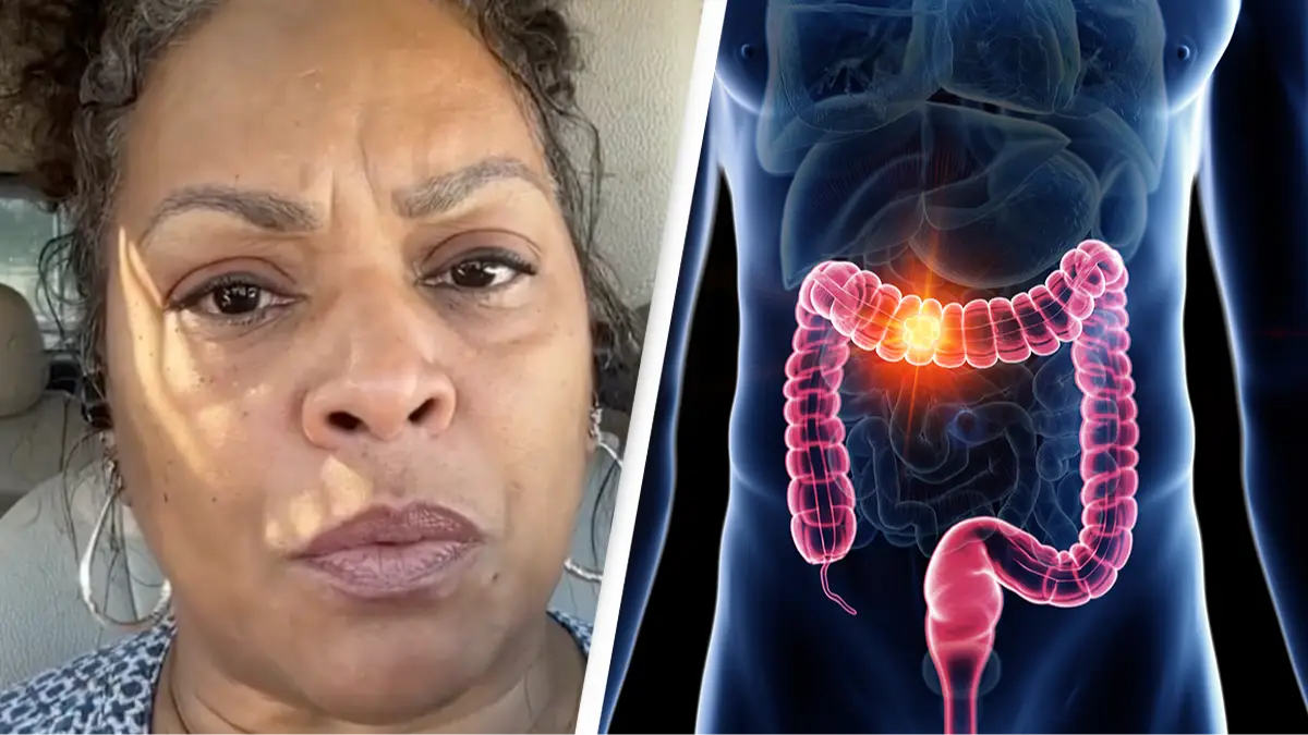 Woman who was diagnosed with stage 3 colon cancer reveals the 5 signs she ignored