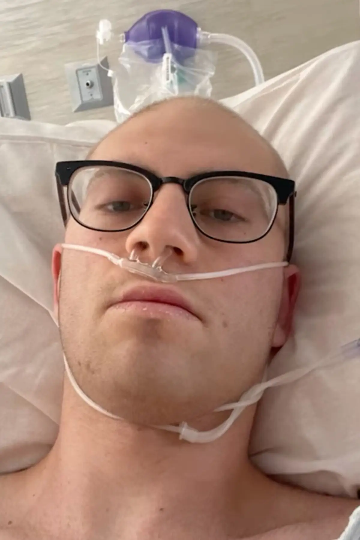 Rob said losing his hair during chemotherapy was 'challenging' (YouTube/The Patient Story)
