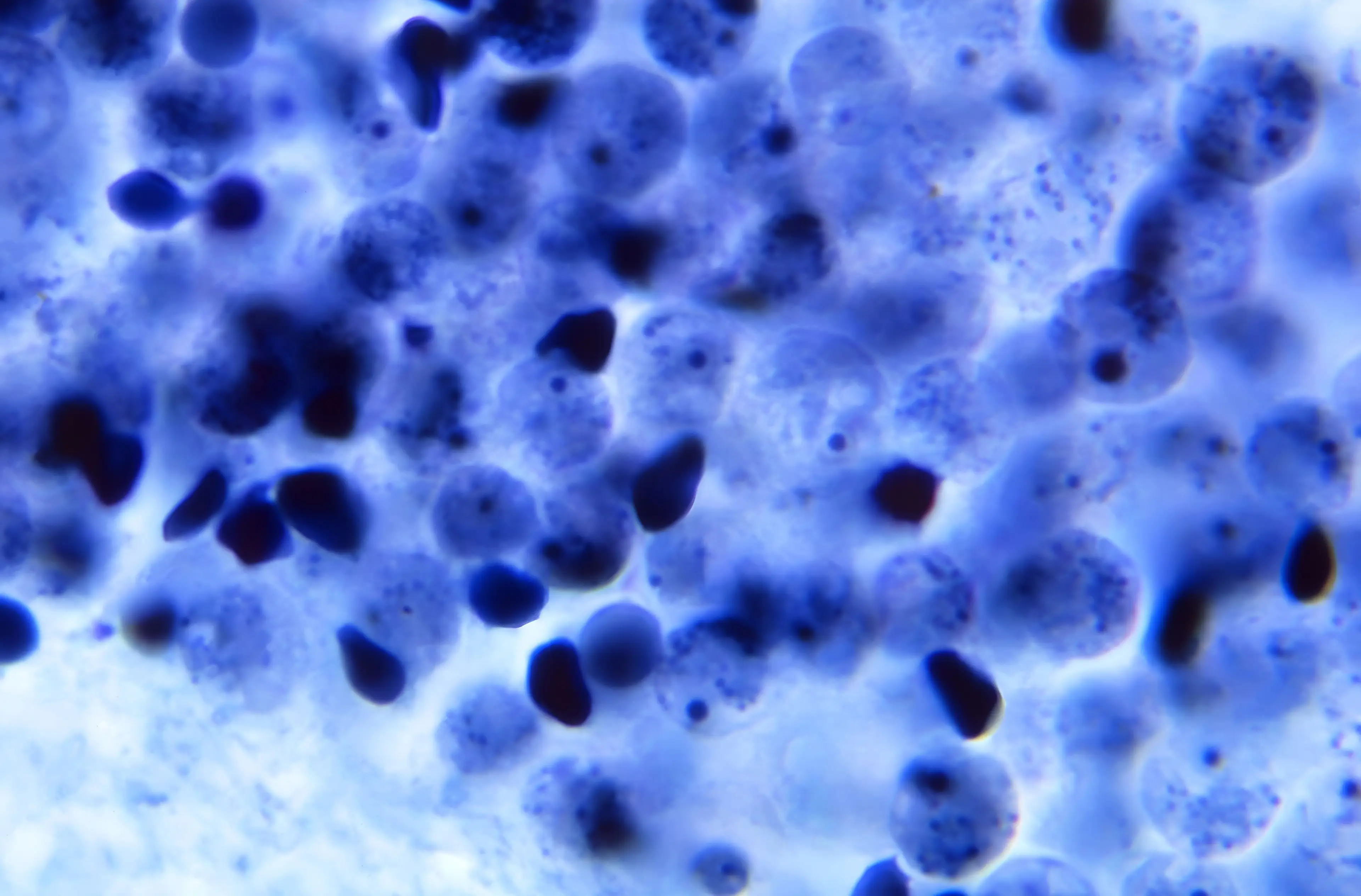 The University of Cambridge study revealed the connections between brains. (Getty Images / BSIP / Contributor)