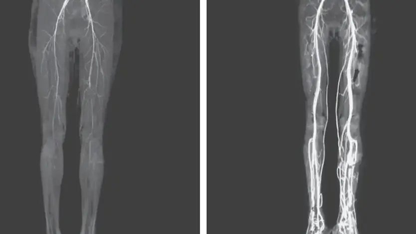 The New England Journal of Medicine