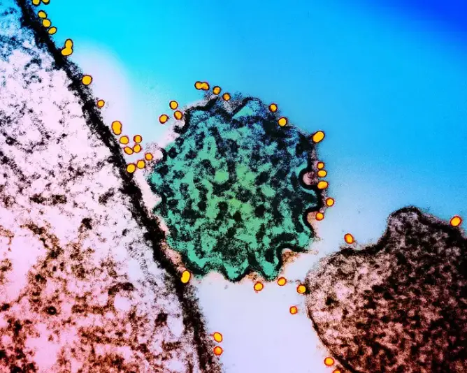 Thailand is just one of many Asian nations taking steps to prevent the spread of the Nipah virus ((NIH-NIAID/Image Point FR/BSIP/Universal Images Group via Getty Images)