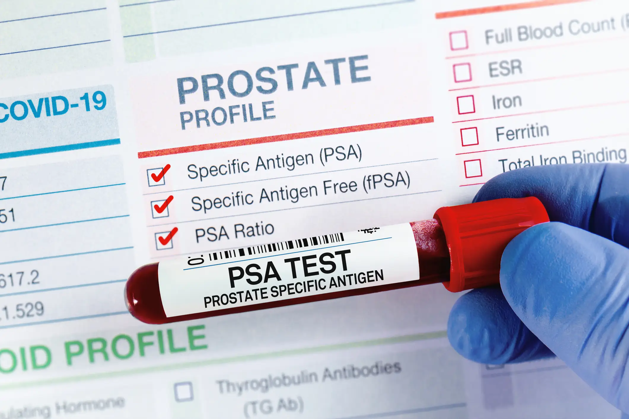 PSA tests can reduce the risk of death dramatically (Getty Stock Image)