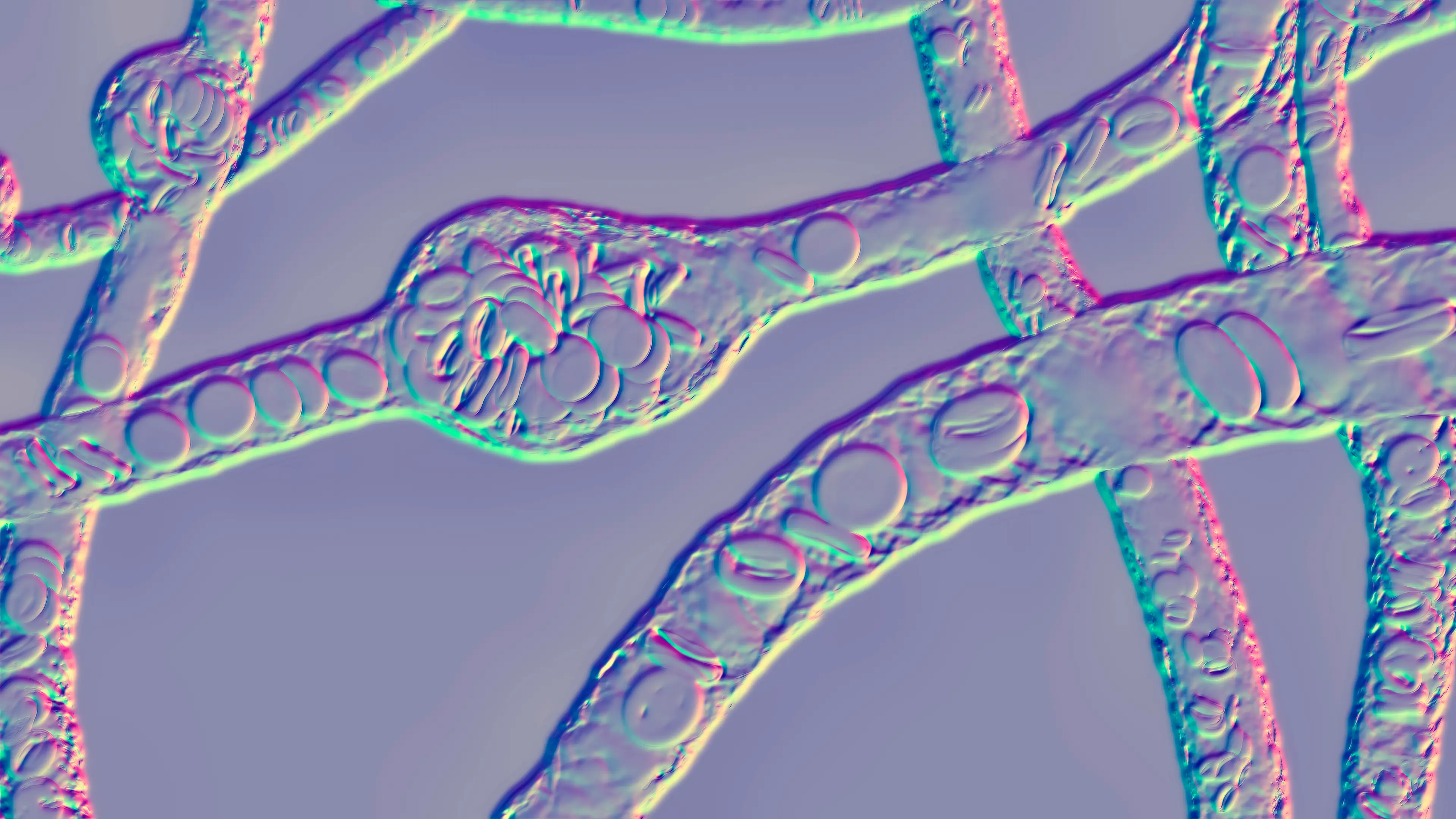 Aneurysms occur when a blood vessel bulges (stock image).