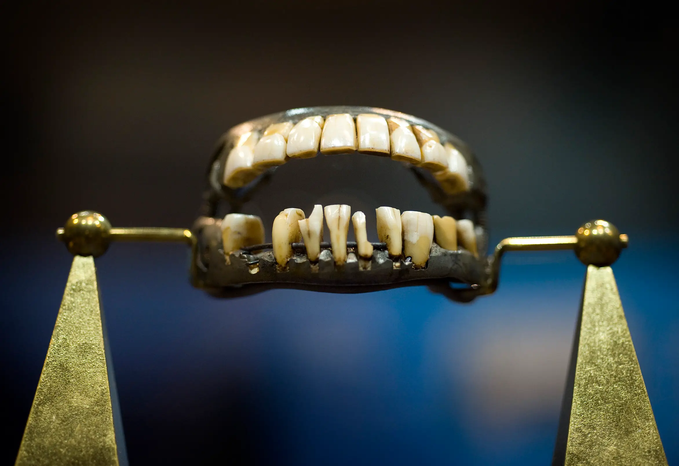 Museums repeatedly have to inform guests that George Washington didn't have wooden dentures (Glen Stubbe/Star Tribune via Getty Images)