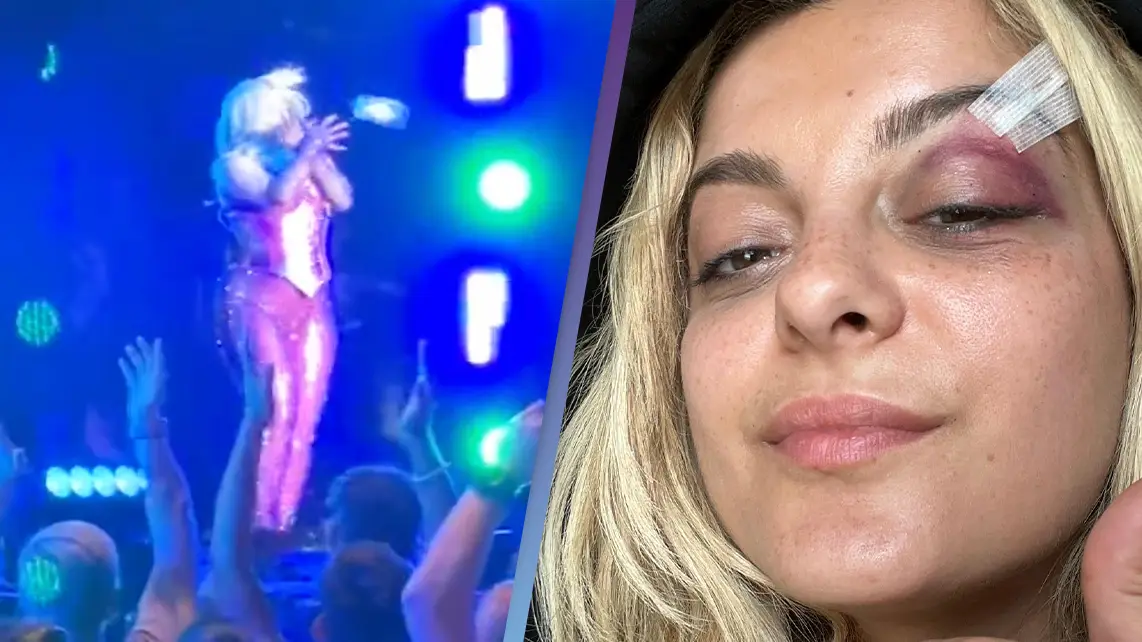 Man charged after Bebe Rexha was hit in the face with a phone during a live performance