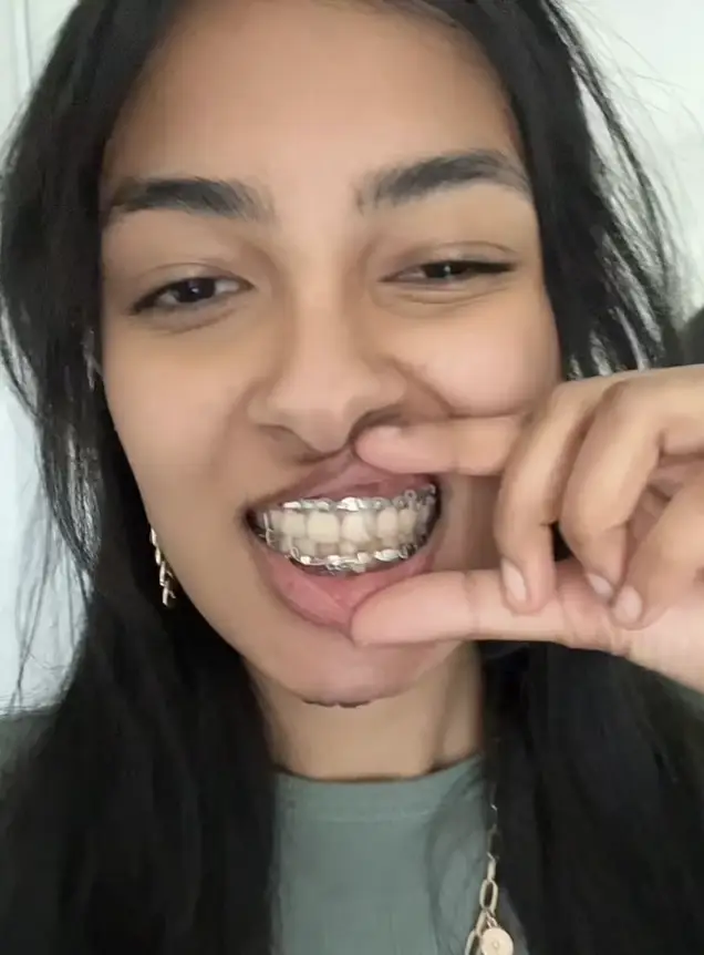 Doctors had to wire her mouth shut for weeks (Kennedy News and Media)