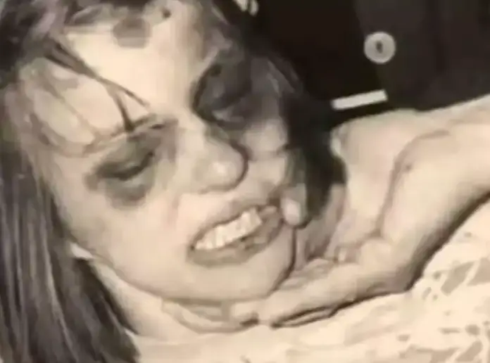 At the time, Anneliese’s condition stumped doctors (Anneliese Michel/Facebook)