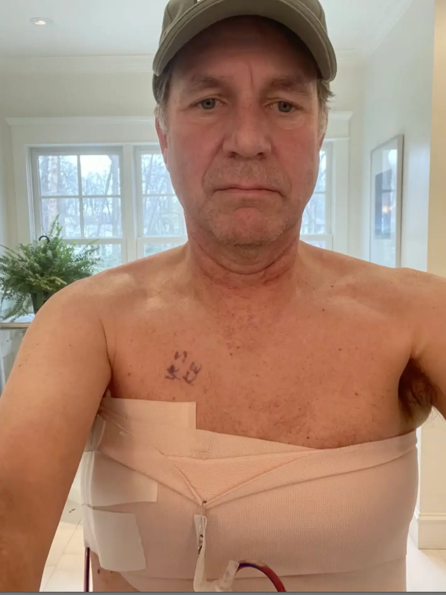 Robert Pfleghardt only discovered he had a cancerous tumor growing thanks to a friend giving him a 'titty twister' (SWNS)