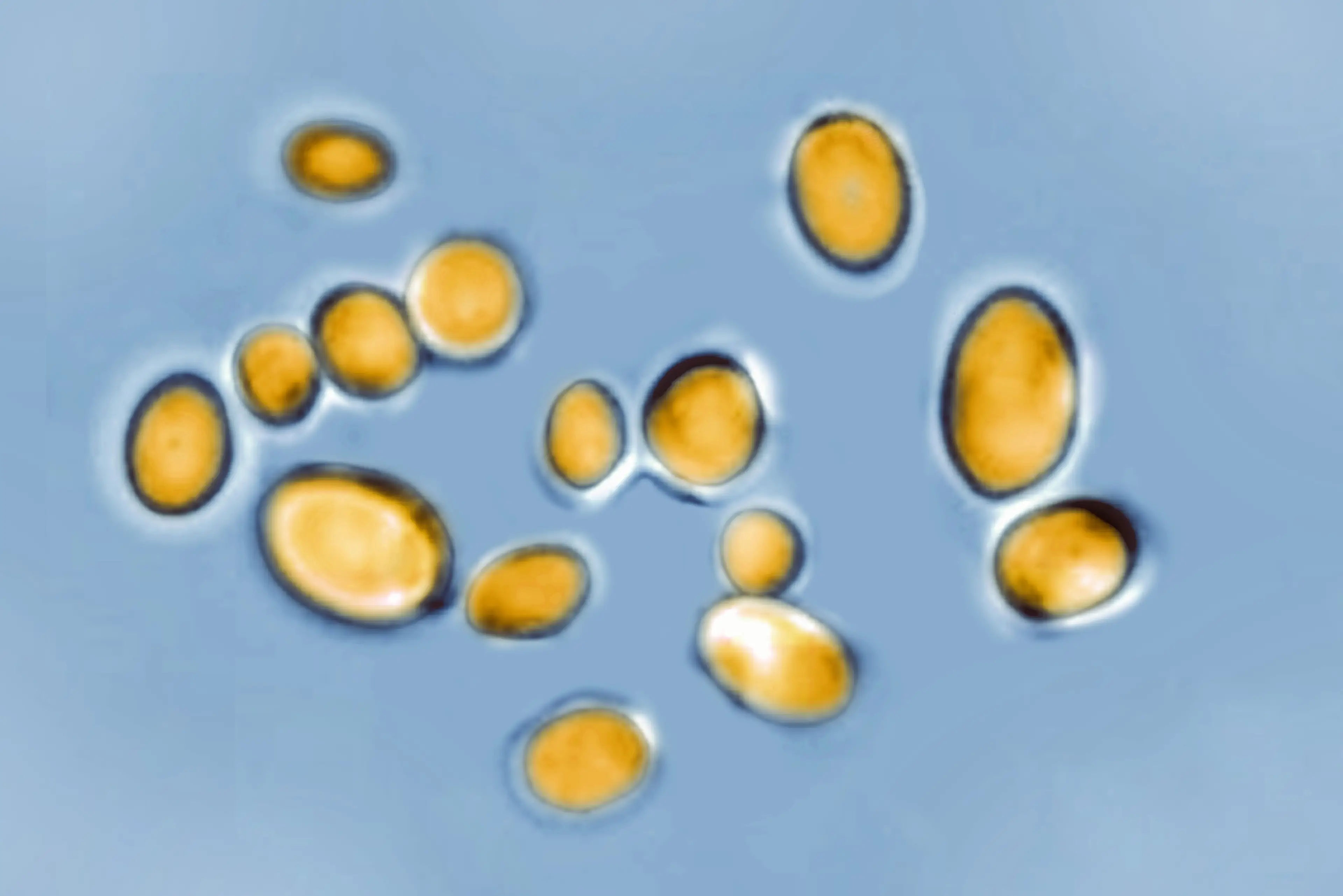 The fungus is particularly hard to treat as it is resistant to most medicines (BSIP/Education Images/Universal Images Group via Getty Image)