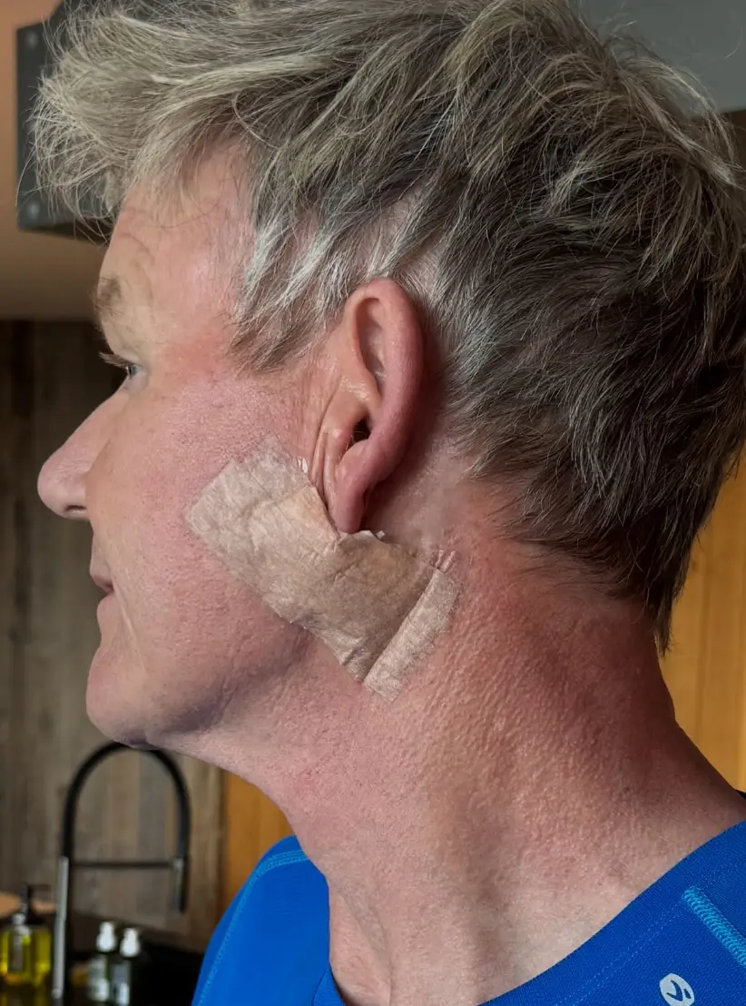 Gordan Ramsay recently had surgery (Instagram/@gordongram)