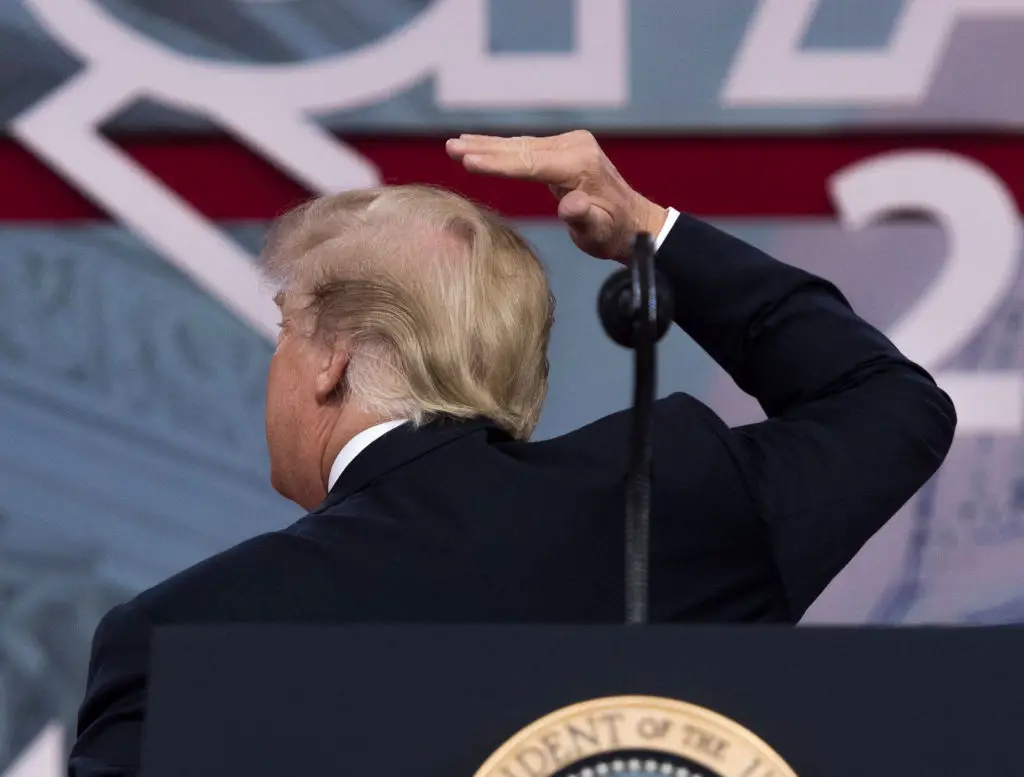That's scalp all right (Photo by SAUL LOEB/AFP via Getty Images)