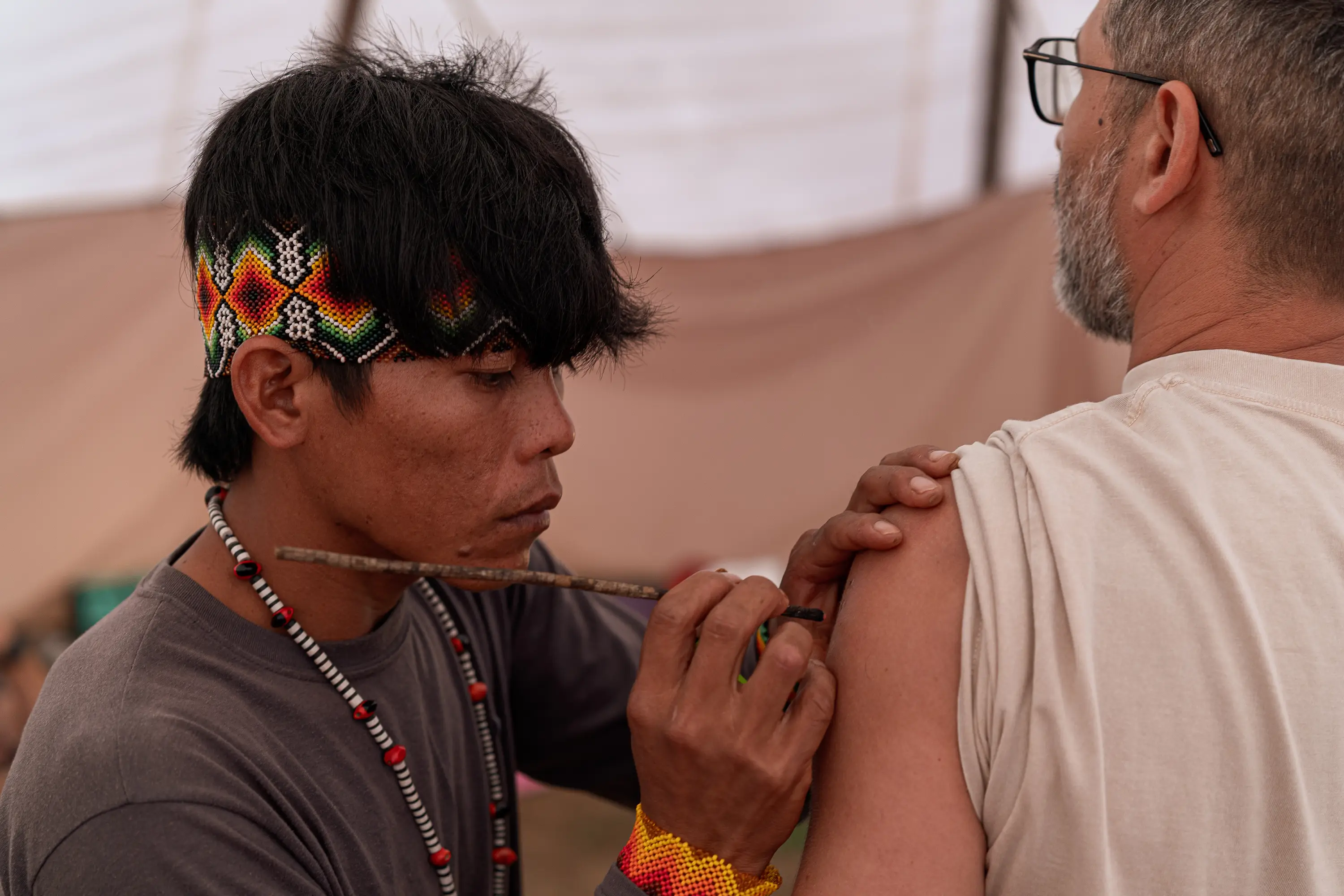 Practitioners burn off the top layer of skin and apply the frog poison to the open wound (Amadeusz Swierk/SOPA Images/LightRocket via Getty Images)