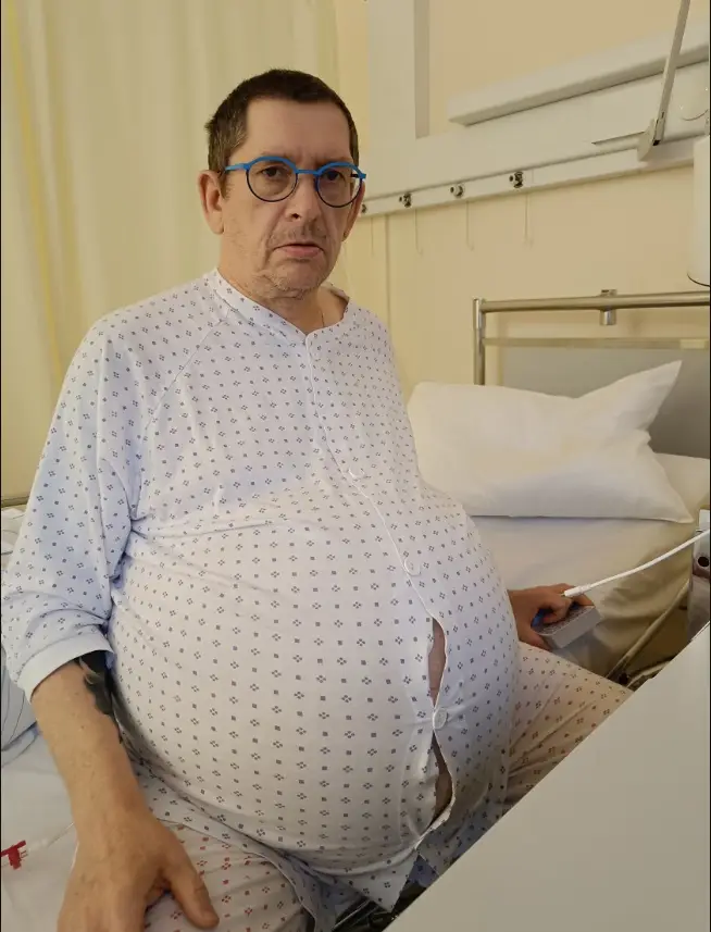 Medical experts later found a tumor (NF/NewsX)