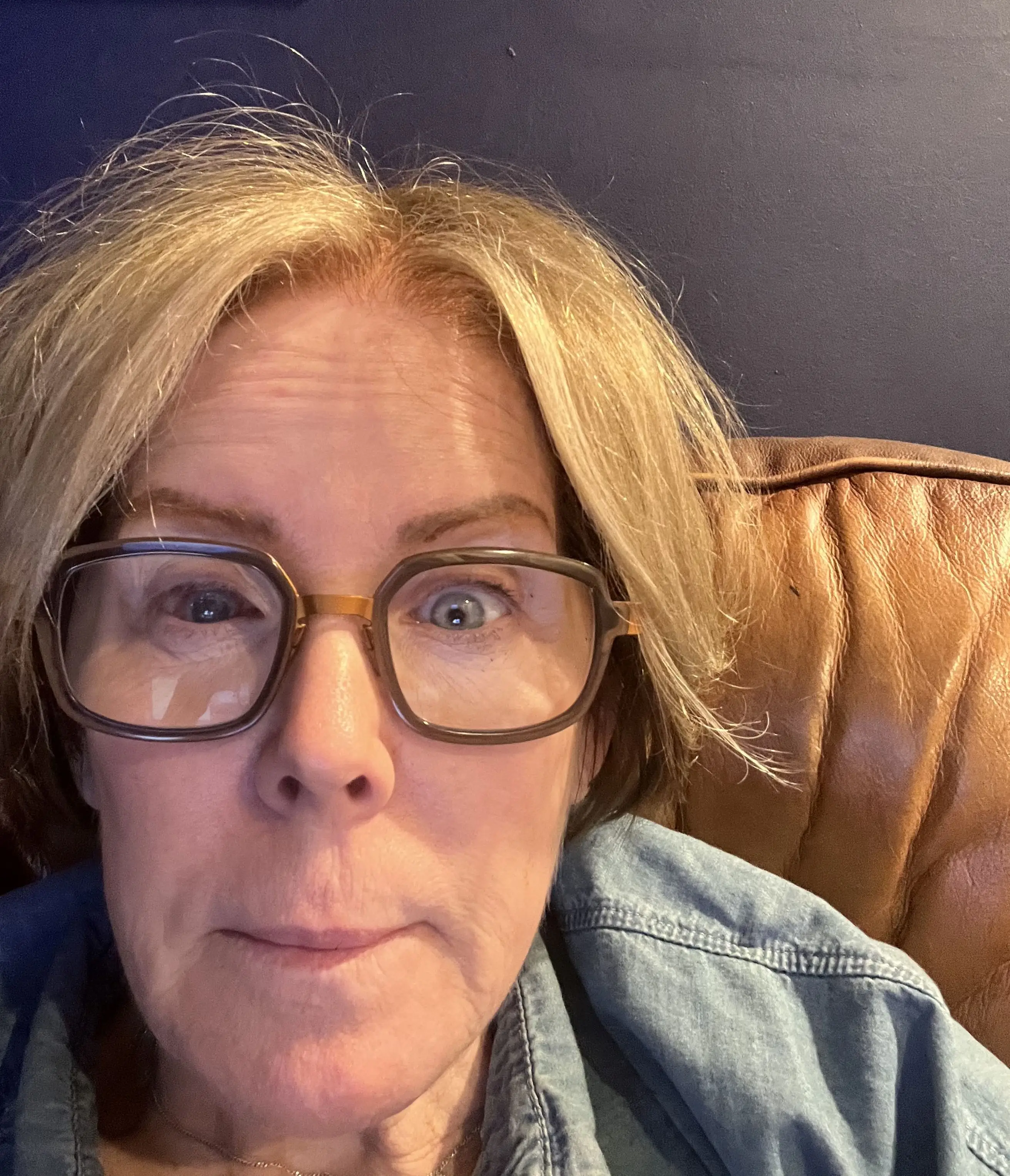 The 53-year-old has almost lost all of her vision in her right eye (Kennedy News and Media)