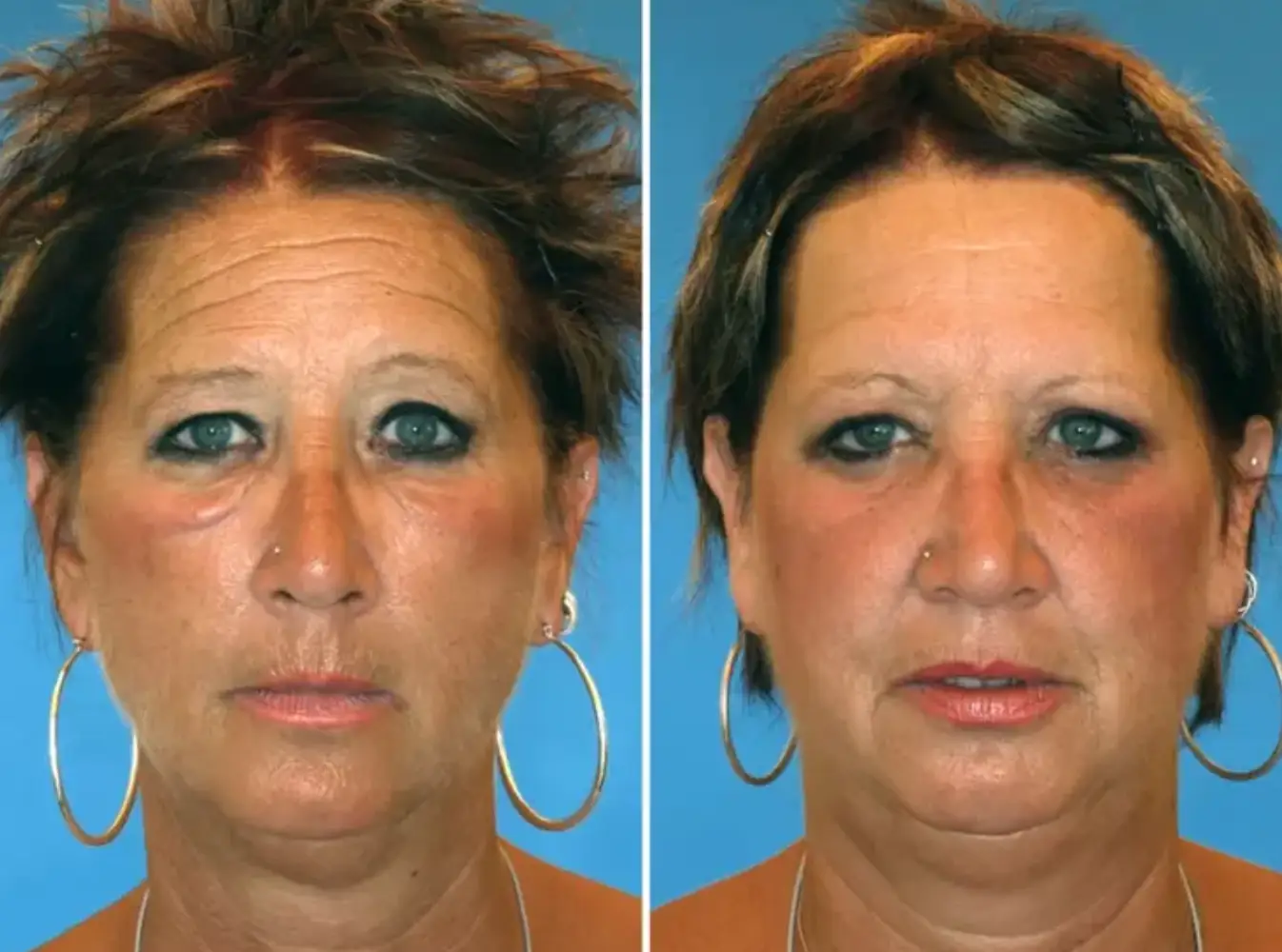 Barb (right) said she's often called 'the younger one' compared to her sister who smokes (NBC)