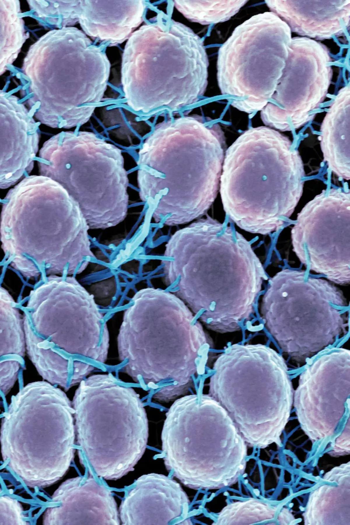 Over 700,000 people contract neisseria gonorrhoeae each year in the US (National Institute of Allergy and Infectious Diseases)