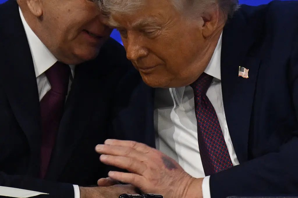 Trump was seen with bruising on his hands last year. (Photo by Harun Ozalp/Anadolu via Getty Images)