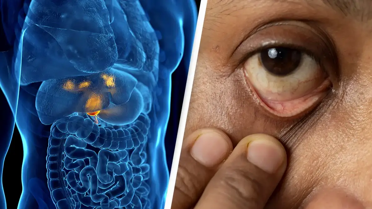 Little-known form of cancer surges in young people and there's one alarming reason why