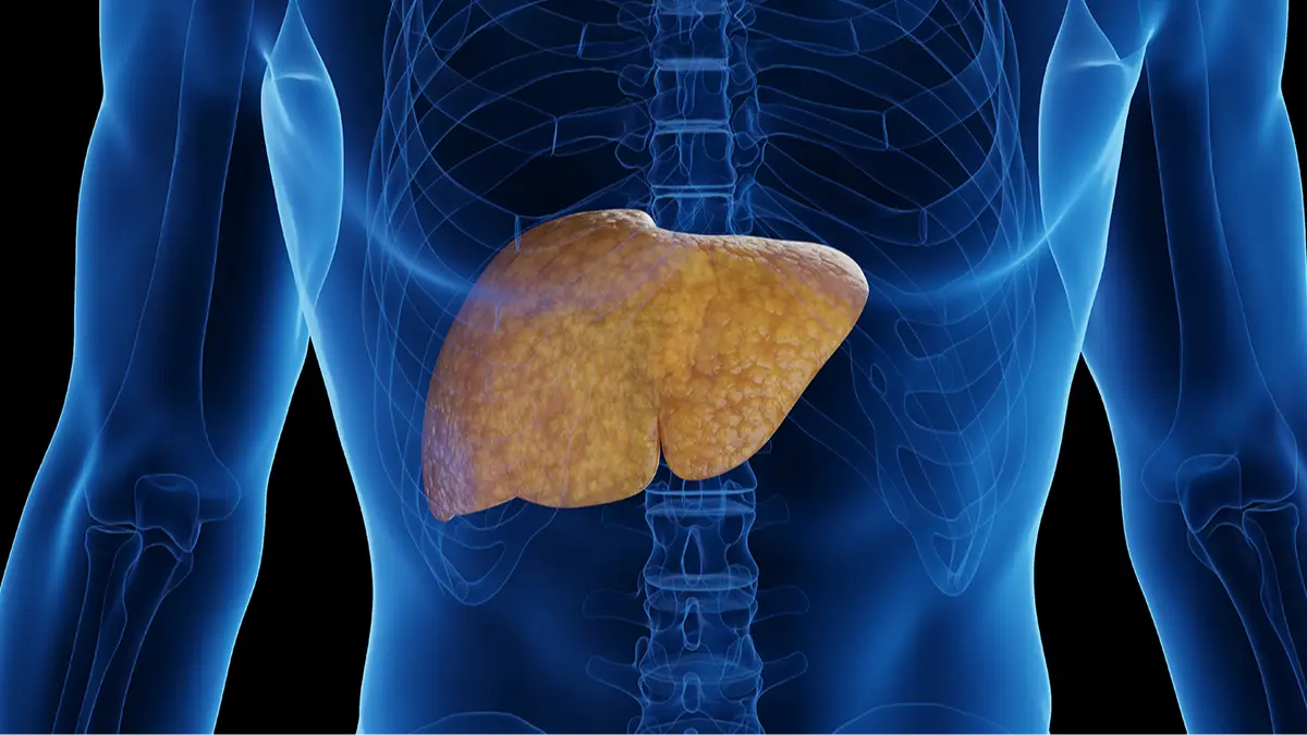 SEBASTIAN KAULITZKI/SCIENCE PHOTO LIBRARY/Getty