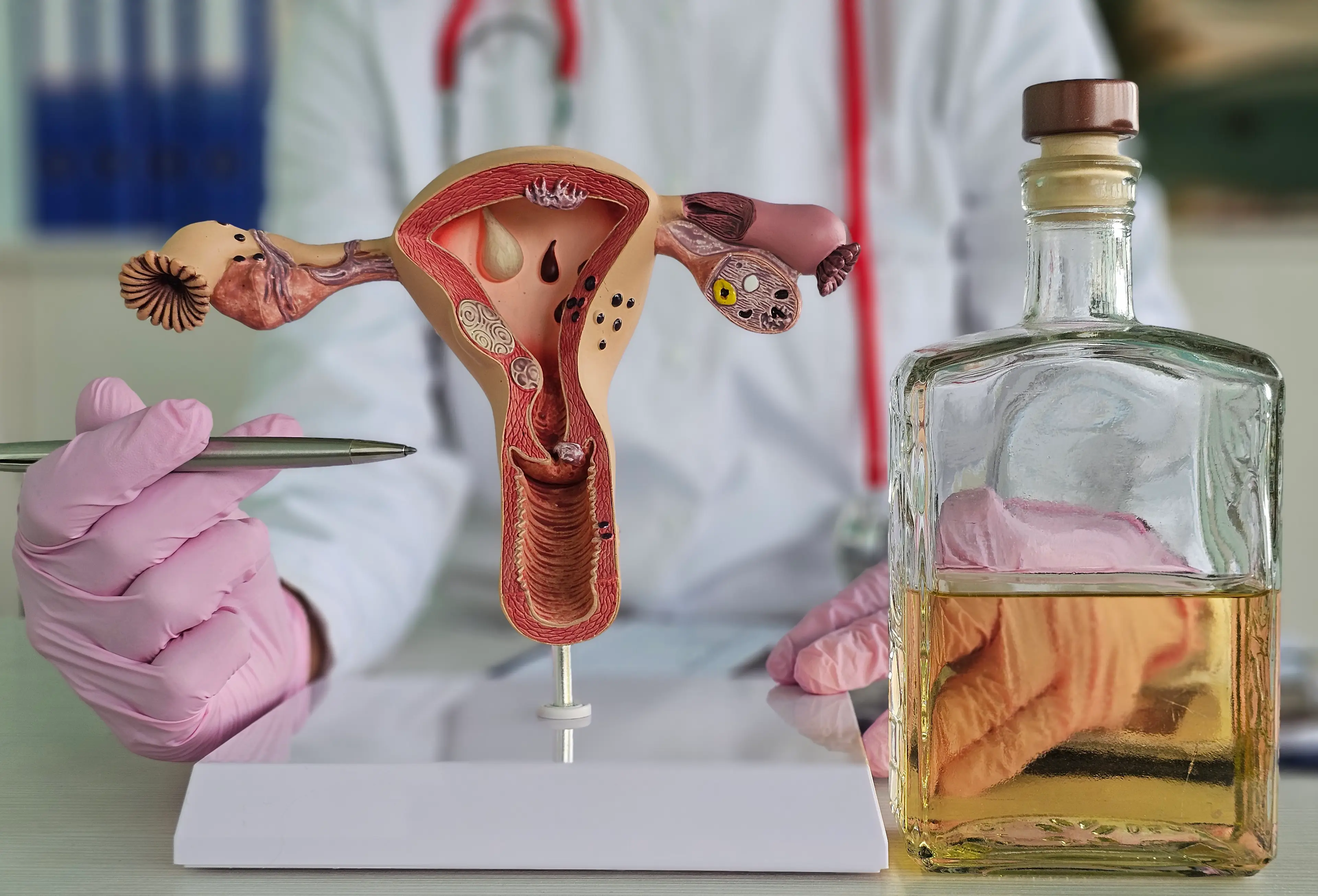 Portsmouth's heavy bleeding and pain was blamed on fibroids in her uterus (Getty Stock Image)