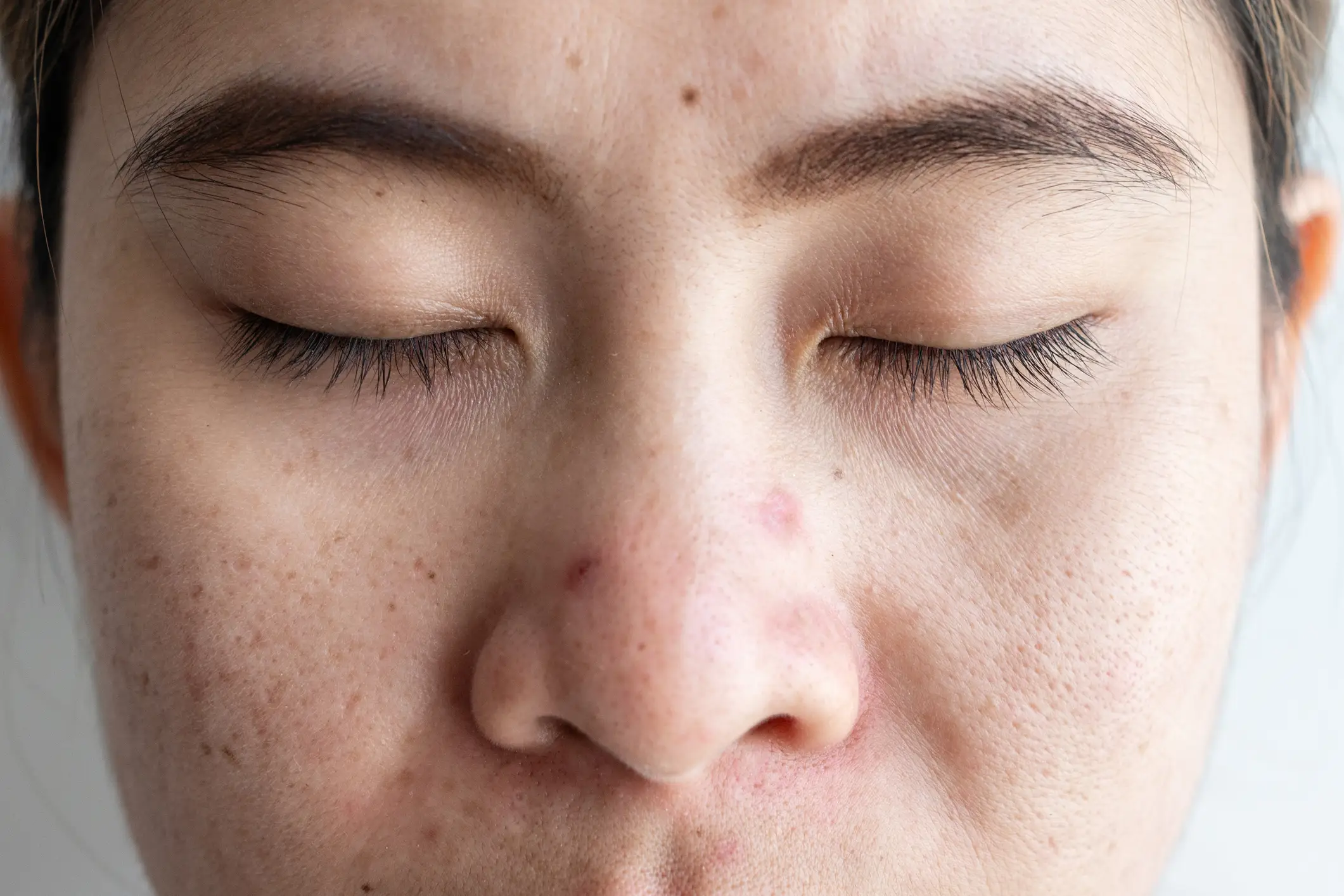 The triangle includes the nose (Getty Stock Photo)