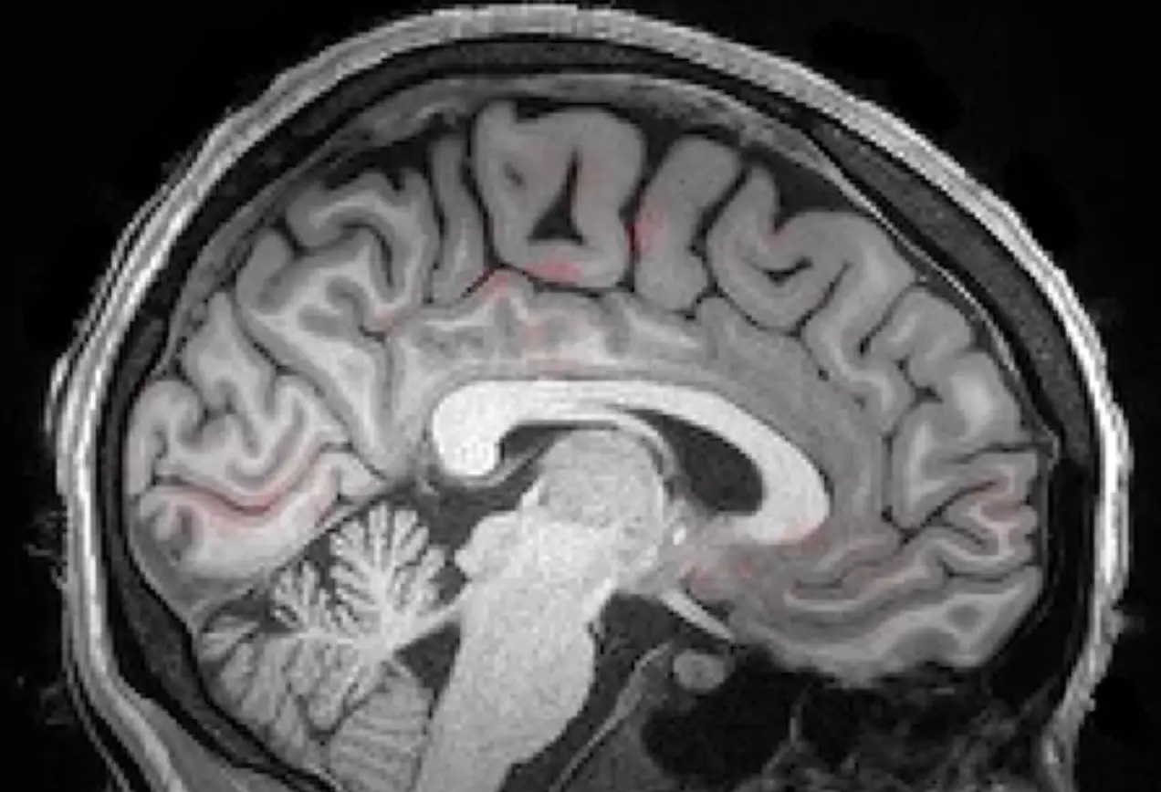 Images of the brain were captured for researchers to analyse how blood and cerebrospinal fluid moved while the person was sleeping (Laura Lewis, N. Fultz et al/Science 2019)