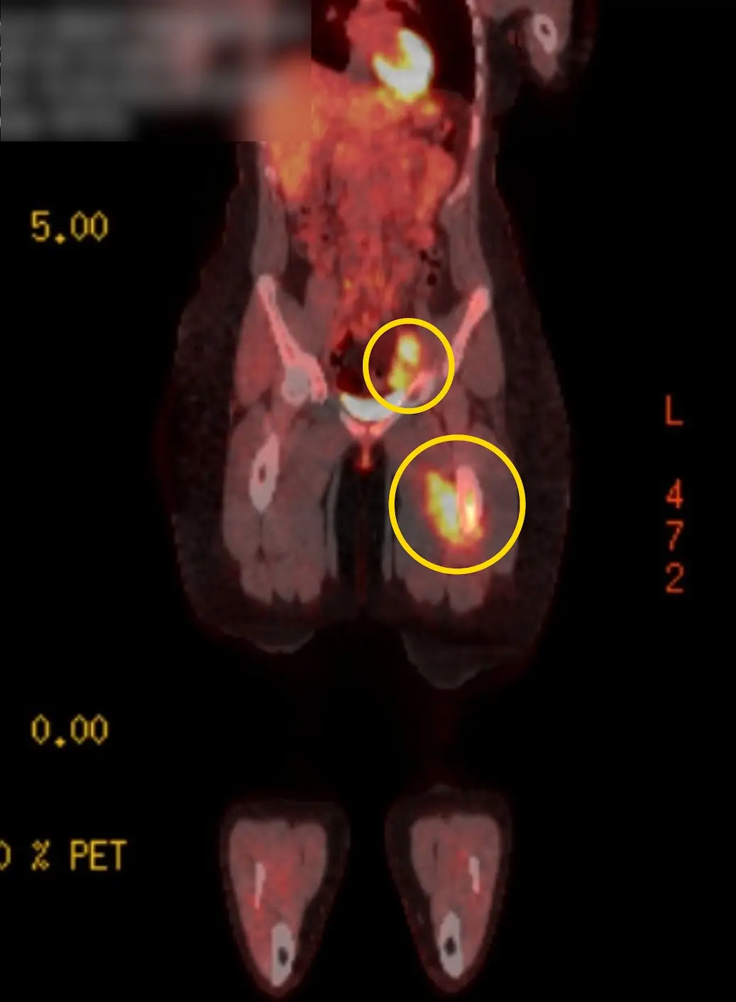 The scans showing the location of the tumors (Kennedy) 