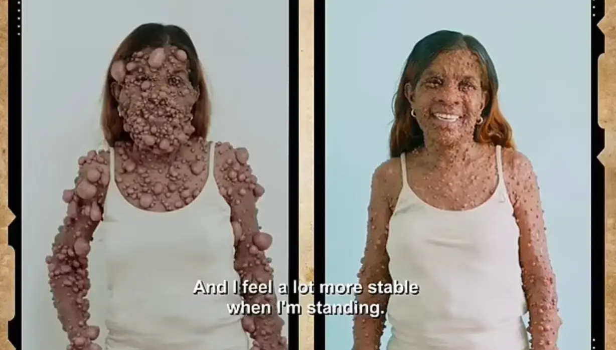 Before and after her surgery.