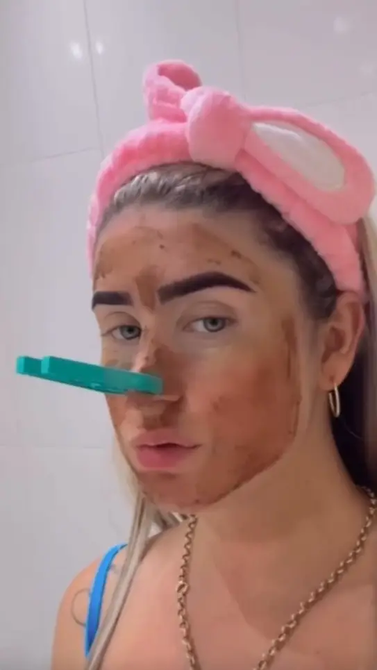 Health experts have warned against the 'trend'. (Jam Press)