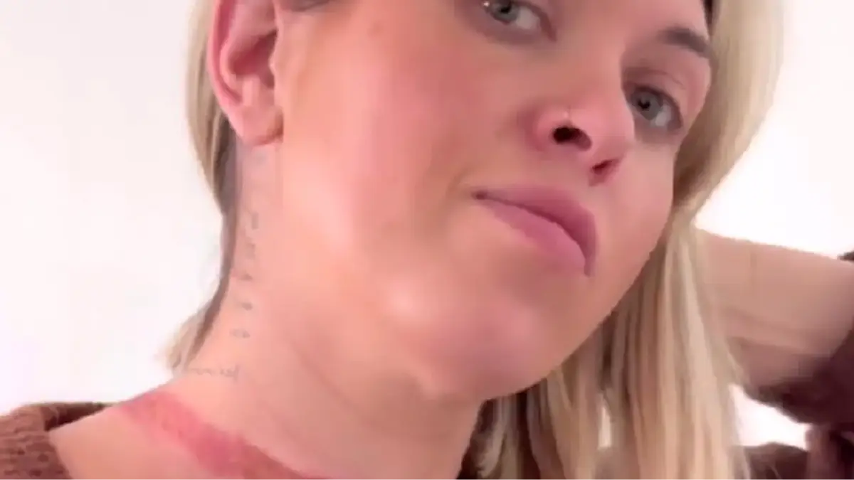 Influencer 'nearly decapitated' after scarf gets stuck under a moving car