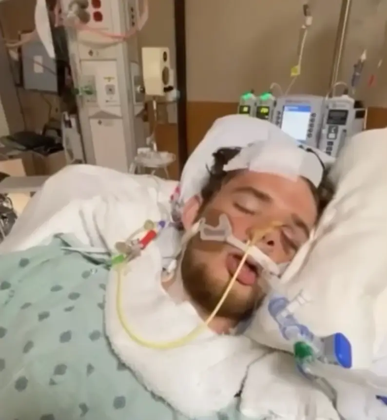 Gabe shattered his skull aged 20 after a skateboarding accident (Fox News)