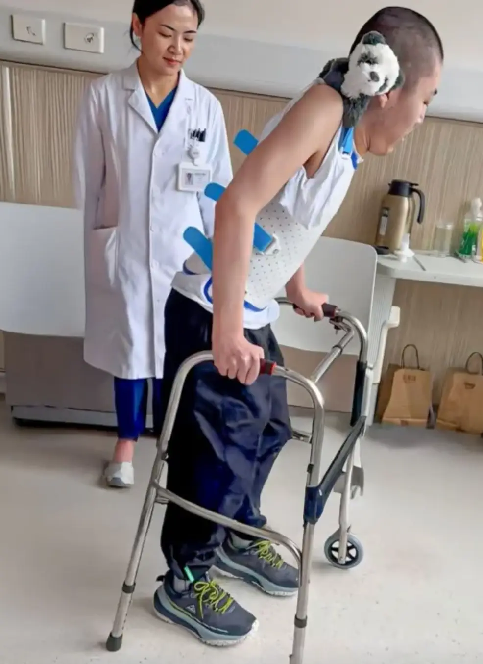 Two months after his final surgery, Jiang took his first upright steps (YouTube/South China Morning Post)