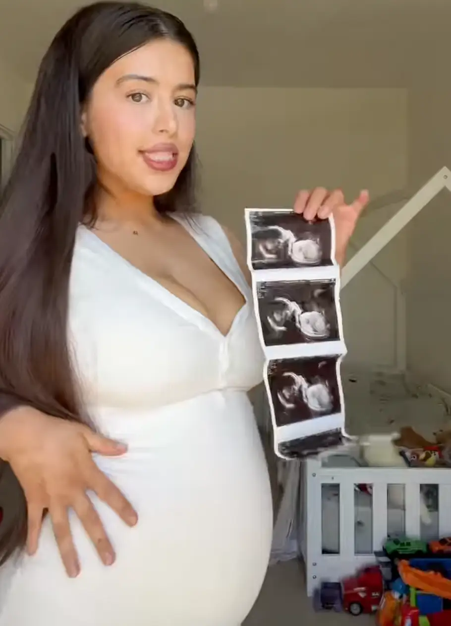 Sophia Grace Brownlee looks completely different these days as she prepares to welcome her third child into the world next month (Instagram/therealsophiagrace)