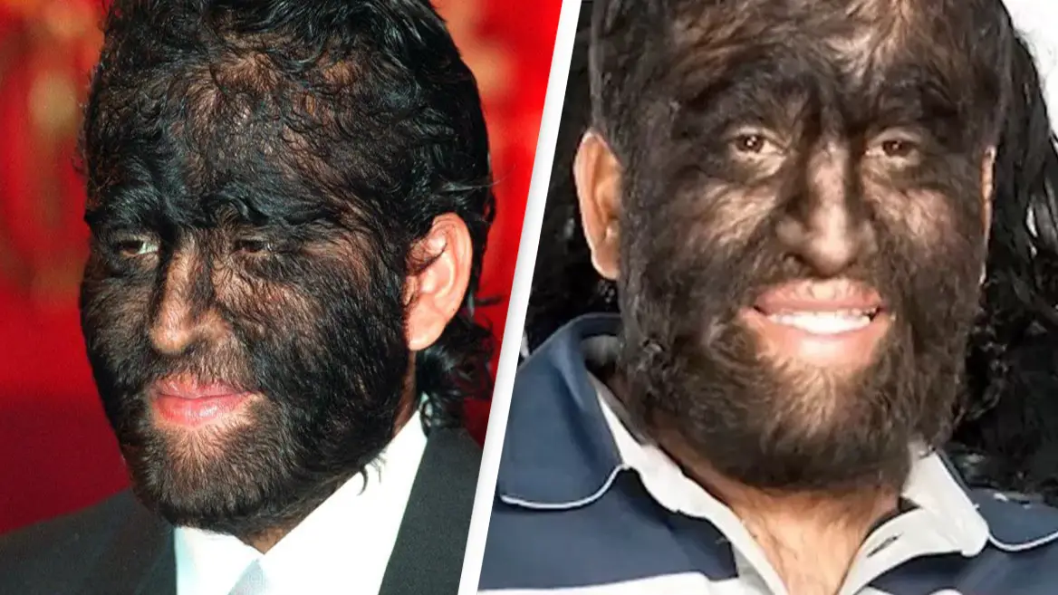 'World's hairiest family' receive support from fans after trolls insult them with cruel nickname