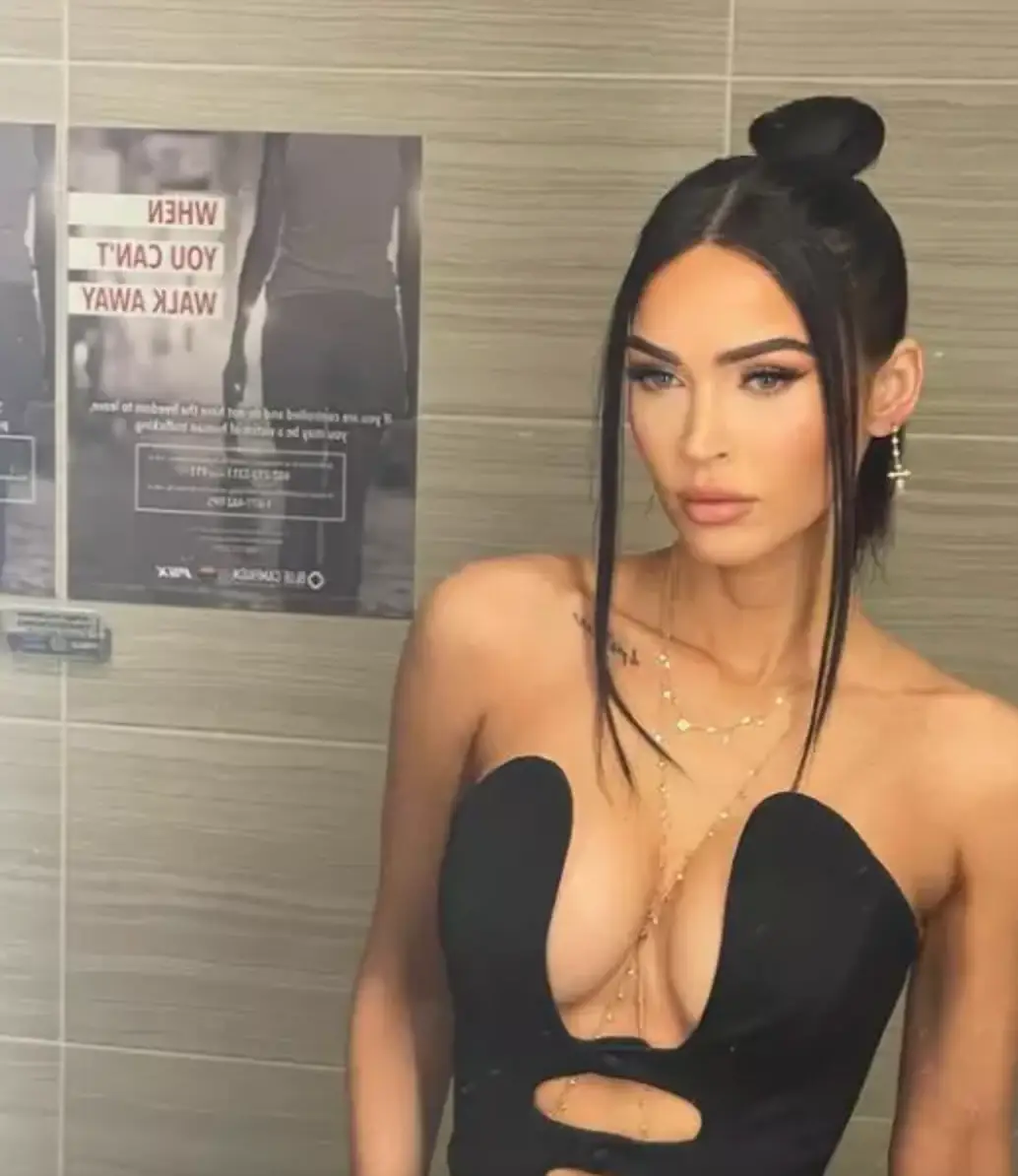 Megan Fox said she is not ‘embarrassed’ about having brachydactyly.