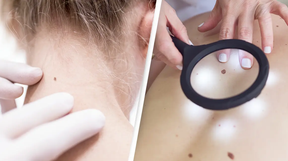 Study reveals millennials face higher risk of 17 cancers than older generations