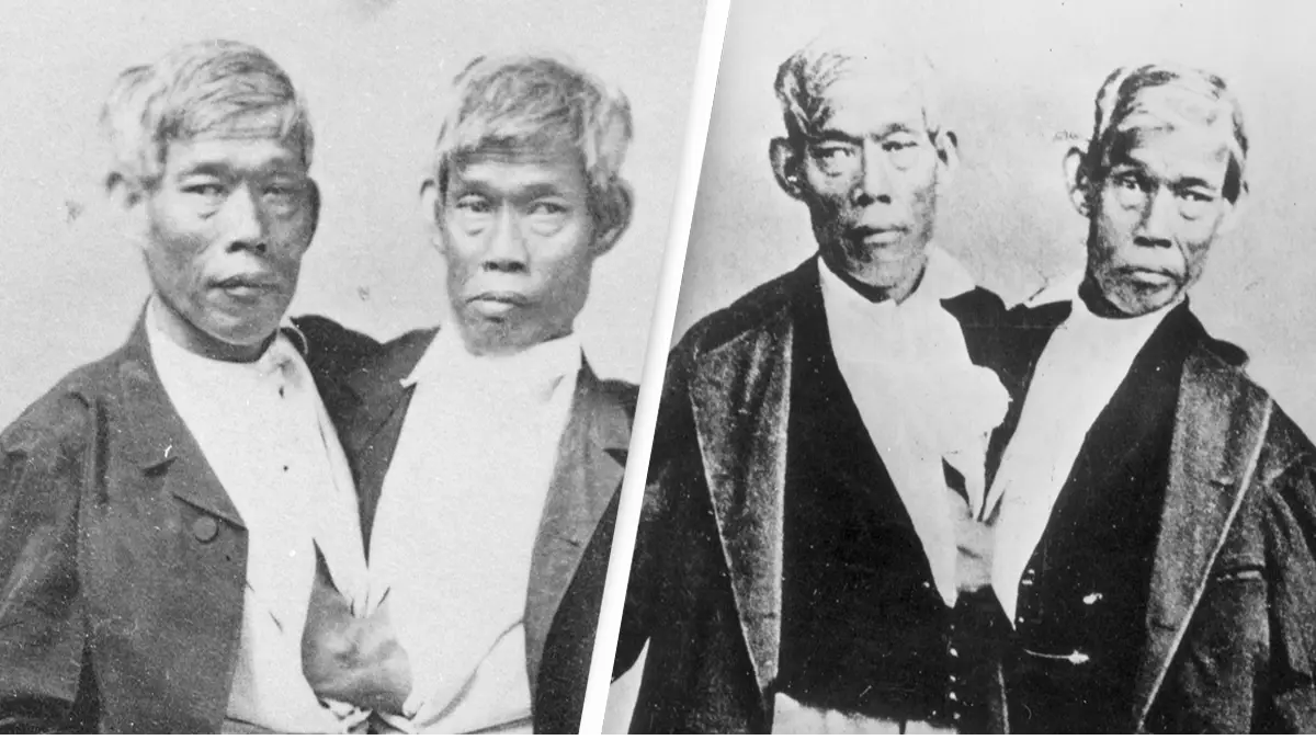 World famous conjoined twins fathered 21 children during their lifetime