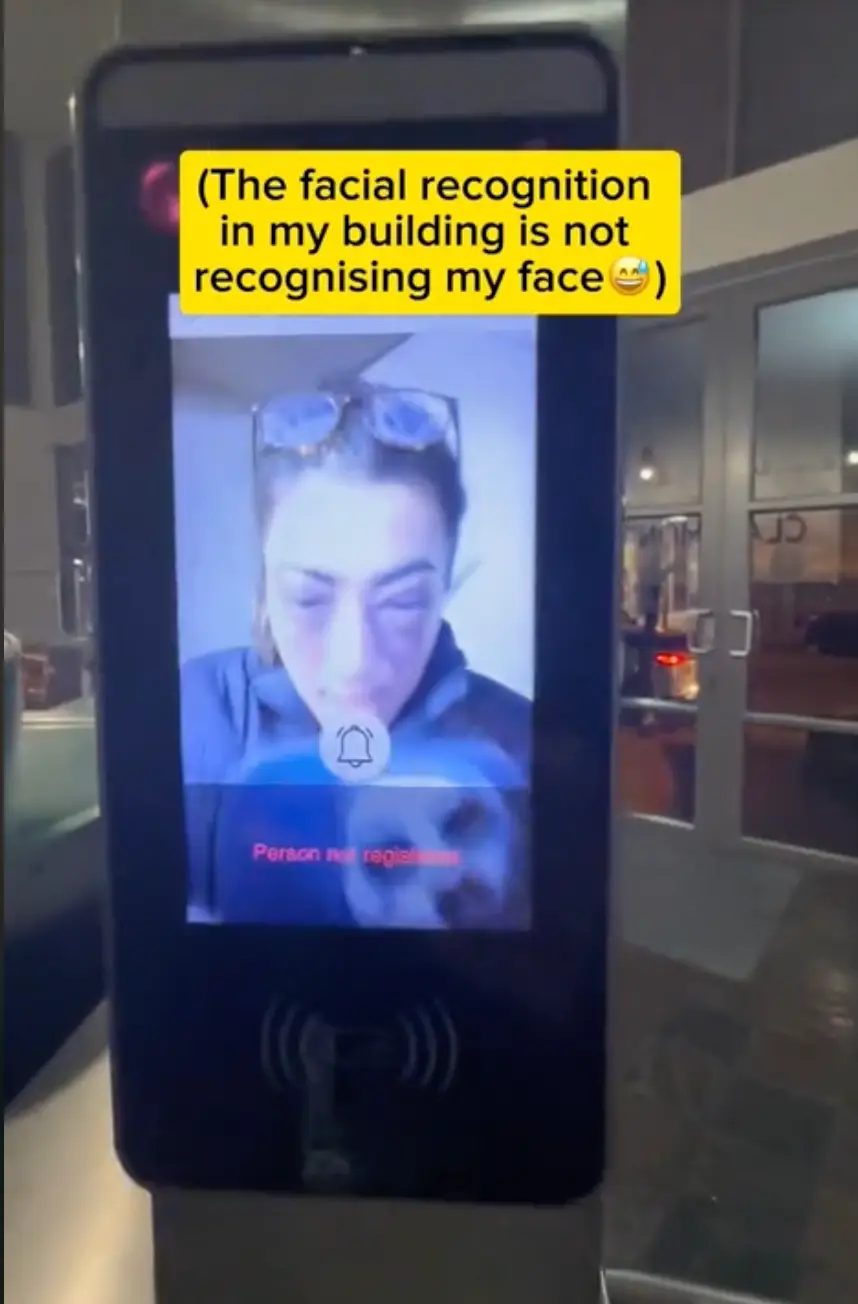 The influencer's face was so swollen the security system wouldn't recognise her.