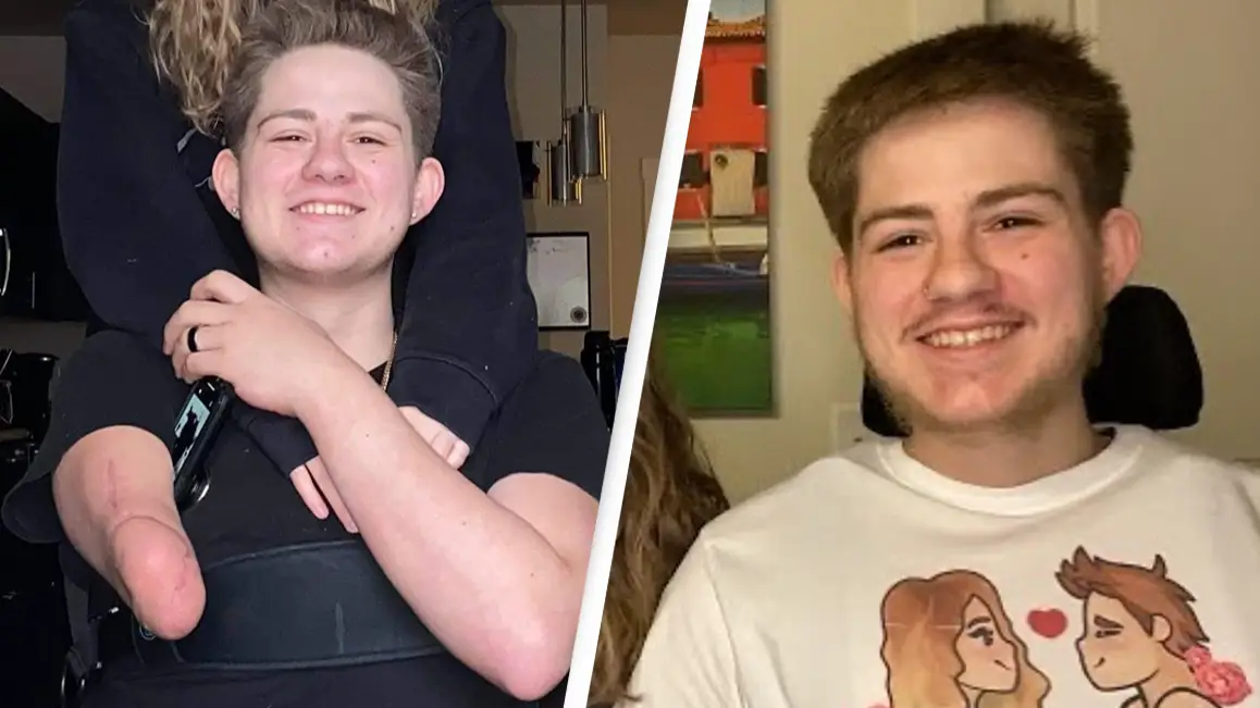 Man chopped in half by forklift answers the question everyone is always asking him