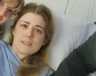 The condition typically affects the face (GoFundMe)