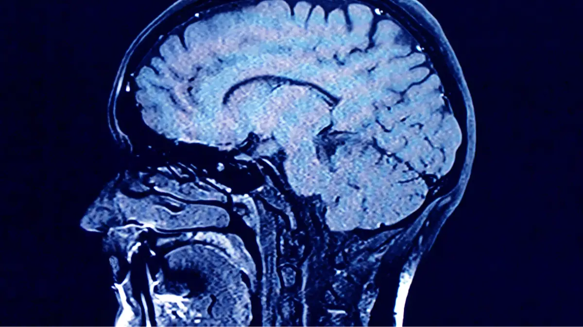 Getty Images/Roxana Wegner