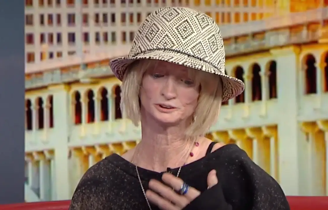 Tiffany was diagnosed with the condition in her twenties (FOX 8 News Cleveland) 