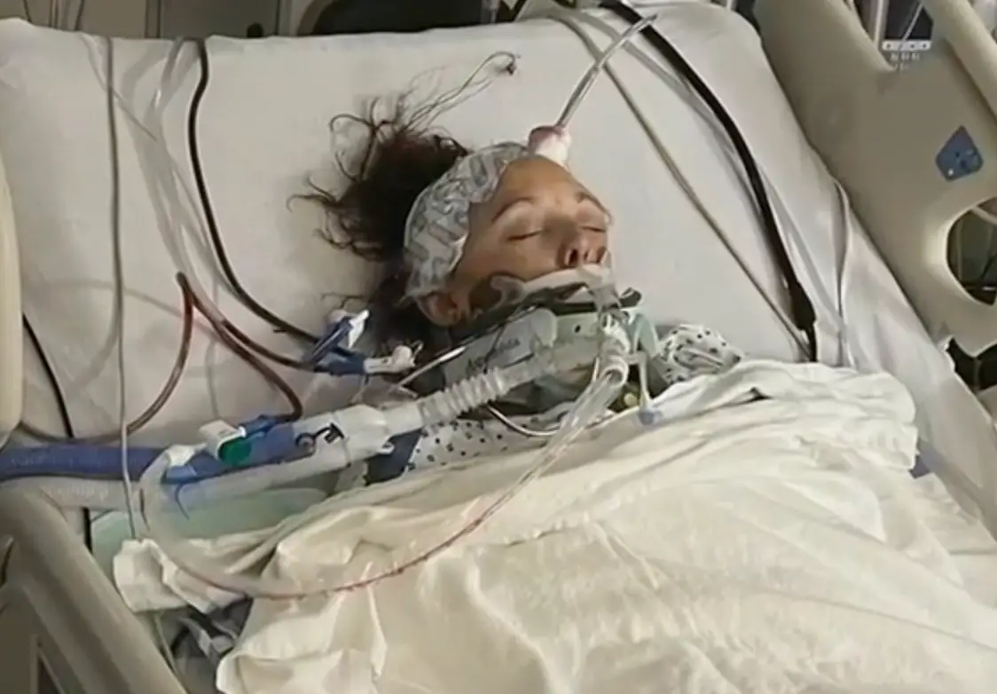 Rachel spent 10 days in a coma.